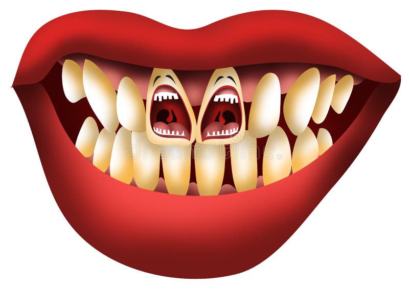 Dents criardes de problème d'aide illustration de vecteur