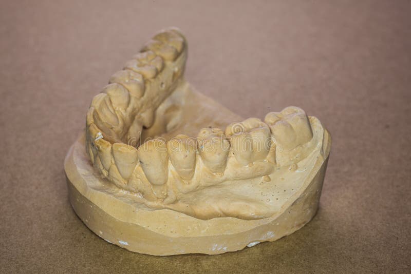 Denture Impression Made of Plaster with Implants Stock Image Image of