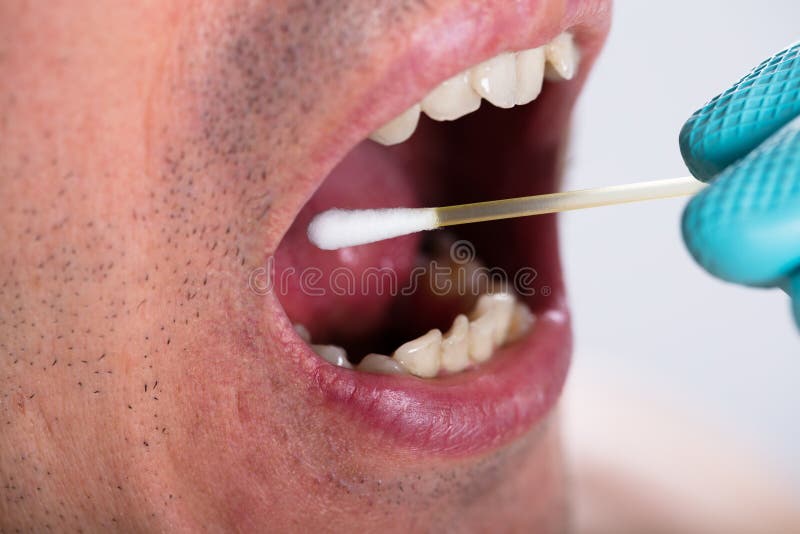 Dentysta Robi ślina testowi Na usta Z Bawełnianym mopem obraz royalty free Dentysta Robi ślina testowi Na usta Z Bawełnianym mopem obraz royalty free