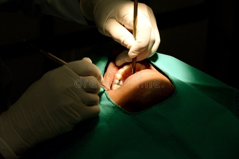 Dentysty egzamininować pod jaskrawym światłem przy stomatologiczną kliniką pacjentów zęby w dentysty krześle zdjęcie royalty free Dentysty egzamininować pod jaskrawym światłem przy stomatologiczną kliniką pacjentów zęby w dentysty krześle zdjęcie royalty free