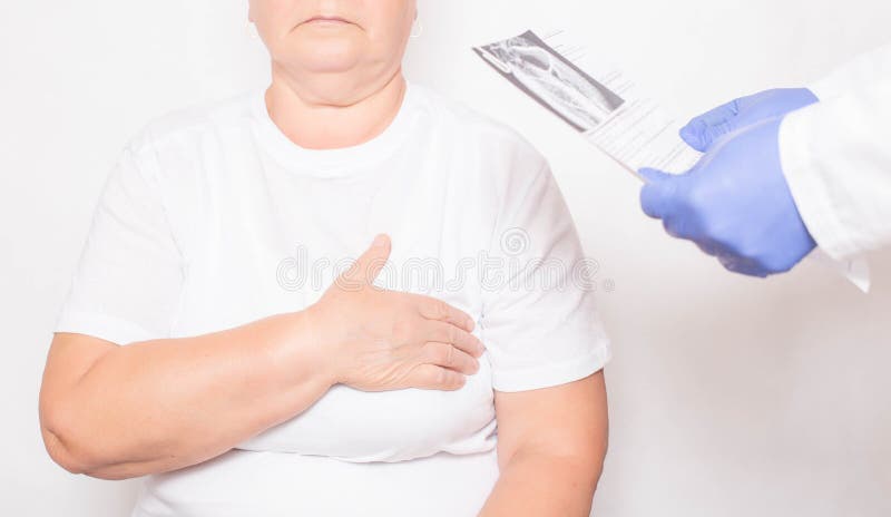 Der Arzt verfügt über die Ergebnisse einer Untersuchung einer älteren Frau mit Herzproblemen Kardiovaskuläre Erkrankungen lizenzfreies stockfoto Der Arzt verfügt über die Ergebnisse einer Untersuchung einer älteren Frau mit Herzproblemen Kardiovaskuläre Erkrankungen lizenzfreies stockfoto