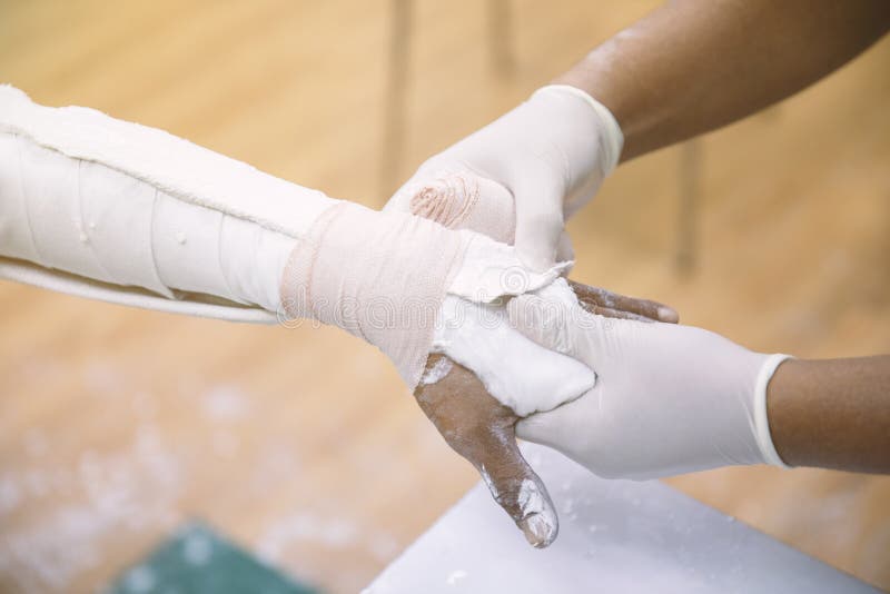 Der Doktor Schient Den Arm Des Patienten Mit Einem Gebrochenen Arm Ein