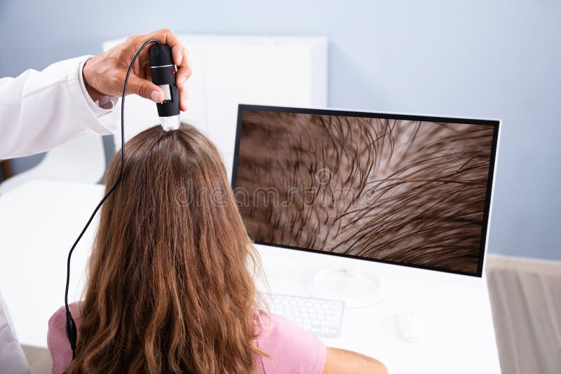 Fielmente inicial Cabra Dermatólogo Con Tricoscopio Para Tratamiento De Caída De Cabello Foto de  archivo - Imagen de medicina, flojo: 210604738