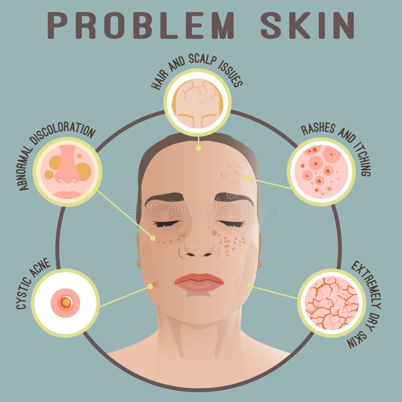 dermatologist icons image important reasons to see woman face skin problems dermatology cosmetology concept vector 99708139