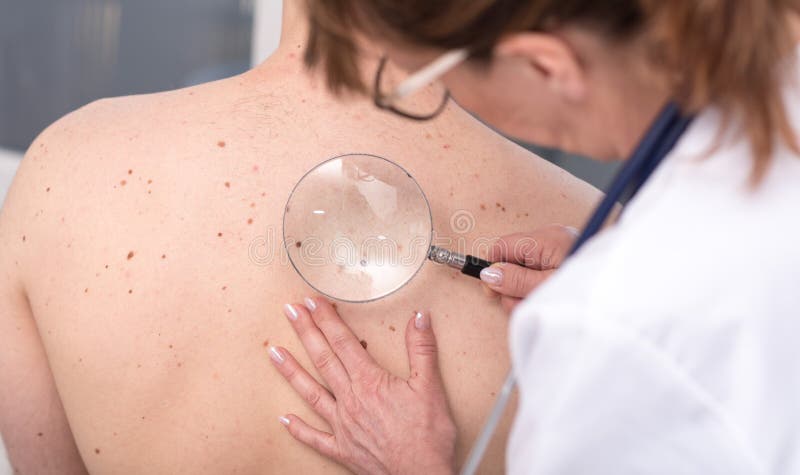 Dermatólogo que examina la piel de un paciente imagen de archivo libre de regalías Dermatólogo que examina la piel de un paciente imagen de archivo libre de regalías