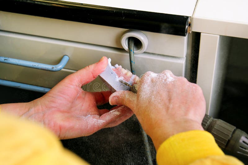 Detaching a Dental Prosthesis Form a Plaster Model Stock Photo Image