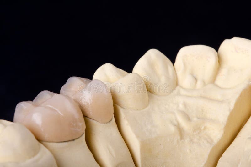 Detail dental wax model stock photo. Image of denture 15794458