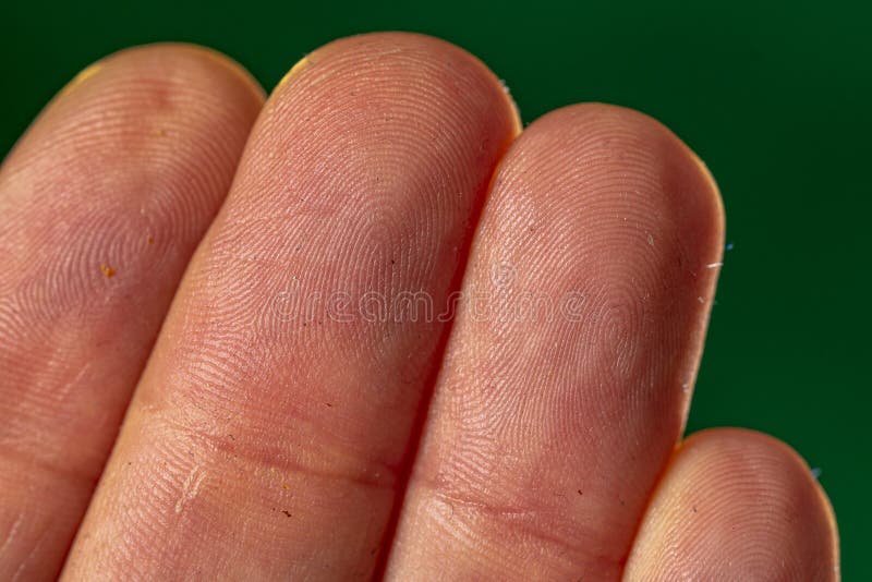 Detail of Part of 4 Fingers Where it is Possible To Observe the