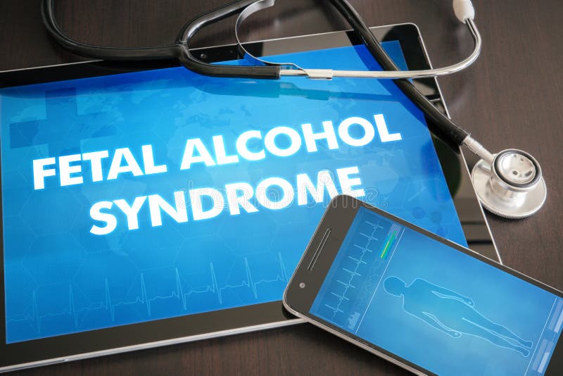 Fetal alcohol syndrome (congenital disorder) diagnosis medical concept on tablet screen with stethoscope. Fetal alcohol syndrome (congenital disorder) diagnosis medical concept on tablet screen with stethoscope.