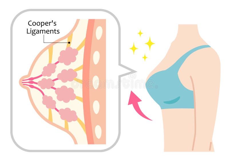 Diagram of Sagging Breasts and Womanâ€™s Body Illustration. Beauty Body and  Health Care Concept Stock Vector - Illustration of breast, appearance:  153831714