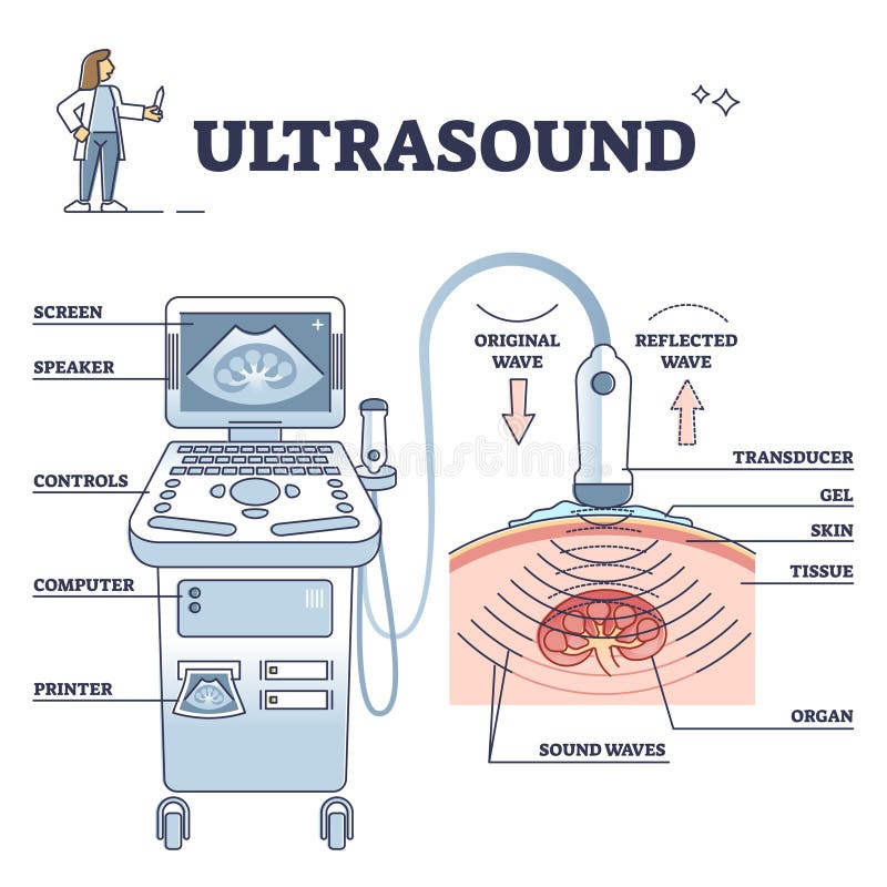 Ultrasound patient analysis process and equipment explanation outline diagram. Radiology scanner for medical research and diagnosis vector illustration. Sonar computer with wave reflection transducer. Ultrasound patient analysis process and equipment explanation outline diagram. Radiology scanner for medical research and diagnosis vector illustration. Sonar computer with wave reflection transducer.