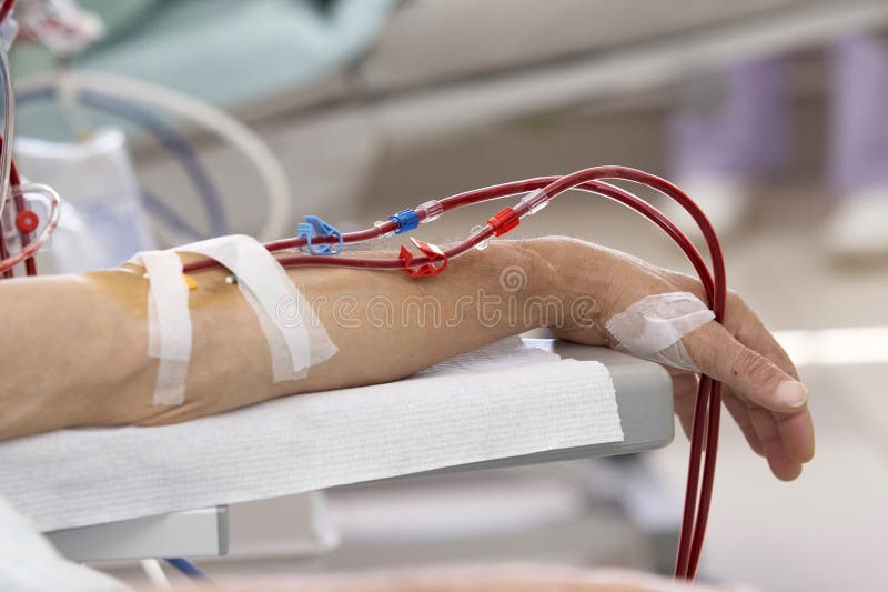 Dialysis 4 stock photography Dialysis 4 stock photography