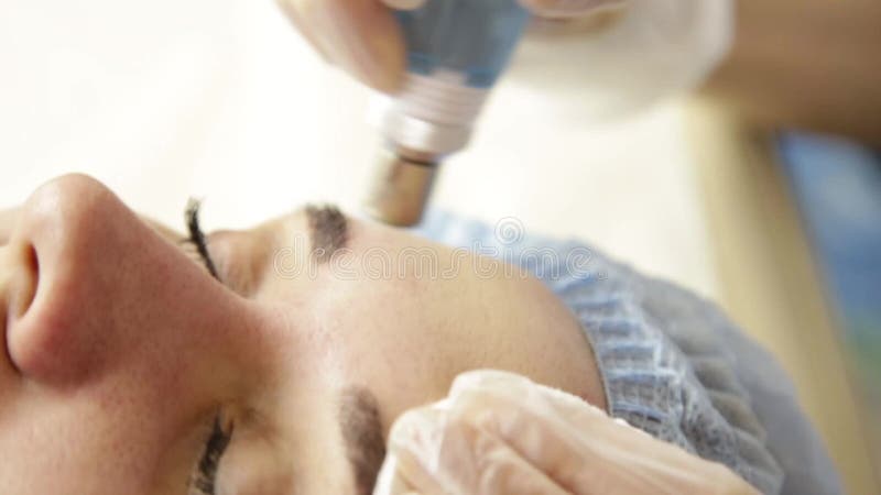Diamond microdermabrasion, peeling treatment at cosmetic beauty spa clinic. woman getting a vacuum microdermabrasion