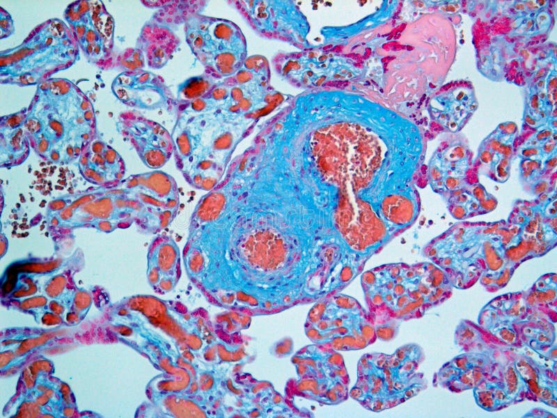 Diapositiva de la histología de la placenta manchada para las mordazas