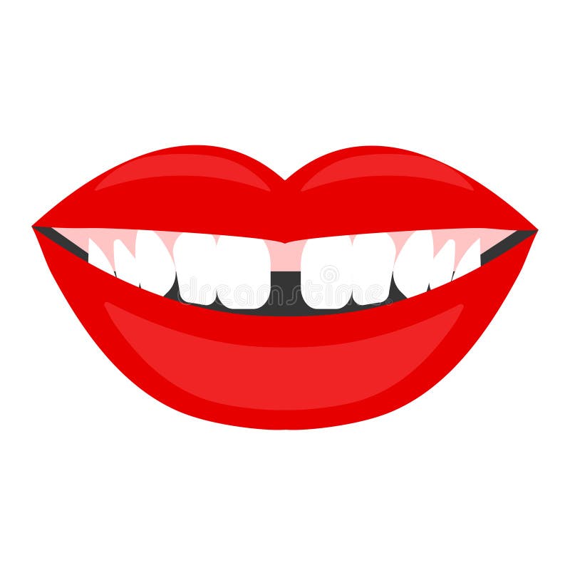 Diastema, Gap between Teeth Stock Vector - Illustration of dentist, facial: 120197148 Diastema, Gap between Teeth Stock Vector - Illustration of dentist, facial: 120197148