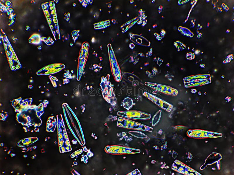 diatoms för 400x dcc royaltyfri bild diatoms för 400x dcc royaltyfri bild