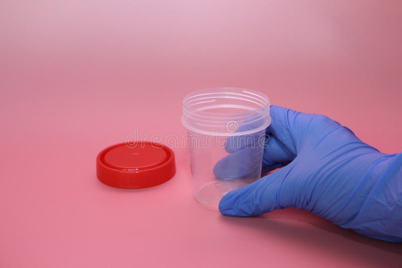 Dien een blauwe latexhandschoen in houdt een container voor het verzamelen van urine royalty-vrije stock foto's Dien een blauwe latexhandschoen in houdt een container voor het verzamelen van urine royalty-vrije stock foto's