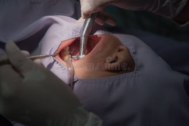 Dientes dentales pacientes por el dentista Dentistry en hospital imagen de archivo libre de regalías Dientes dentales pacientes por el dentista Dentistry en hospital imagen de archivo libre de regalías