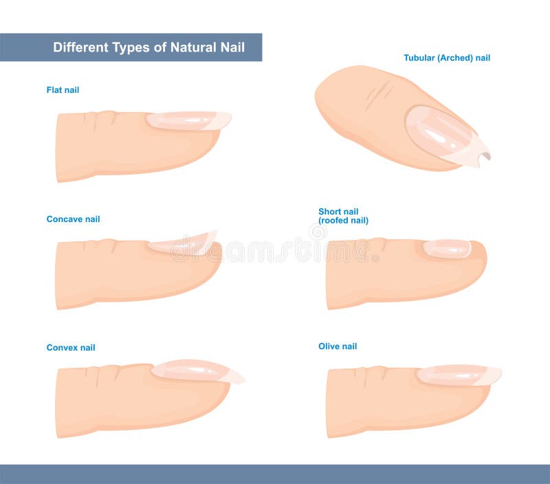 Diferentes tipos de unhas. convexo plano e pregas côncavas, de superfície curta e curta. guia de extensão de unhas. Diferentes tipos de unhas. convexo plano e pregas côncavas, de superfície curta e curta. guia de extensão de unhas.