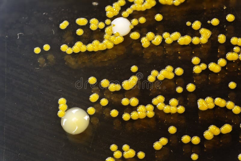 Yellow bacteria colonies on a petri plate stock photo Yellow bacteria colonies on a petri plate stock photo