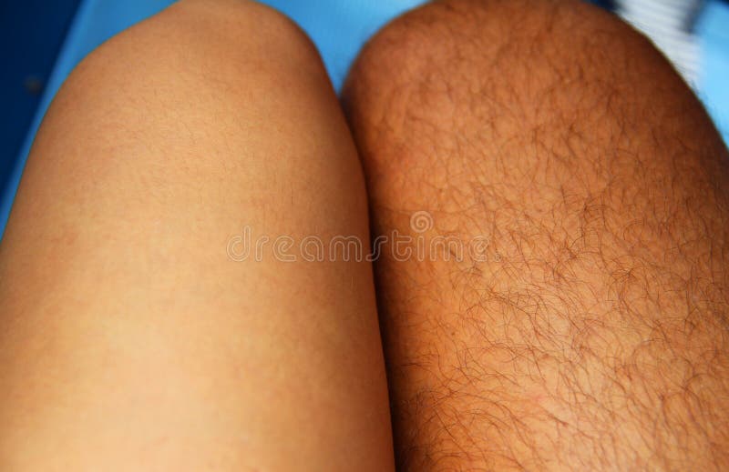 We are so Different - but Still we are Together Stock Photo - Image of  thick, together: 123160272