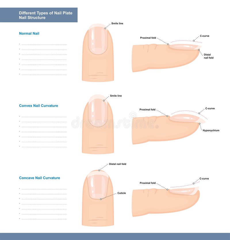 Different Types of Nail Plate. Normal, Convex and Concave Nails. Nail Extension Guide. Vector