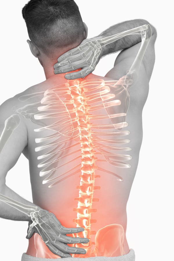 Digitale samenstelling van Benadrukte stekel van de mens met rugpijn