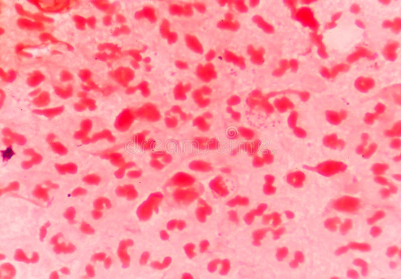 Diplococci gram-negativi intracellulari fotografie stock Diplococci gram-negativi intracellulari fotografie stock