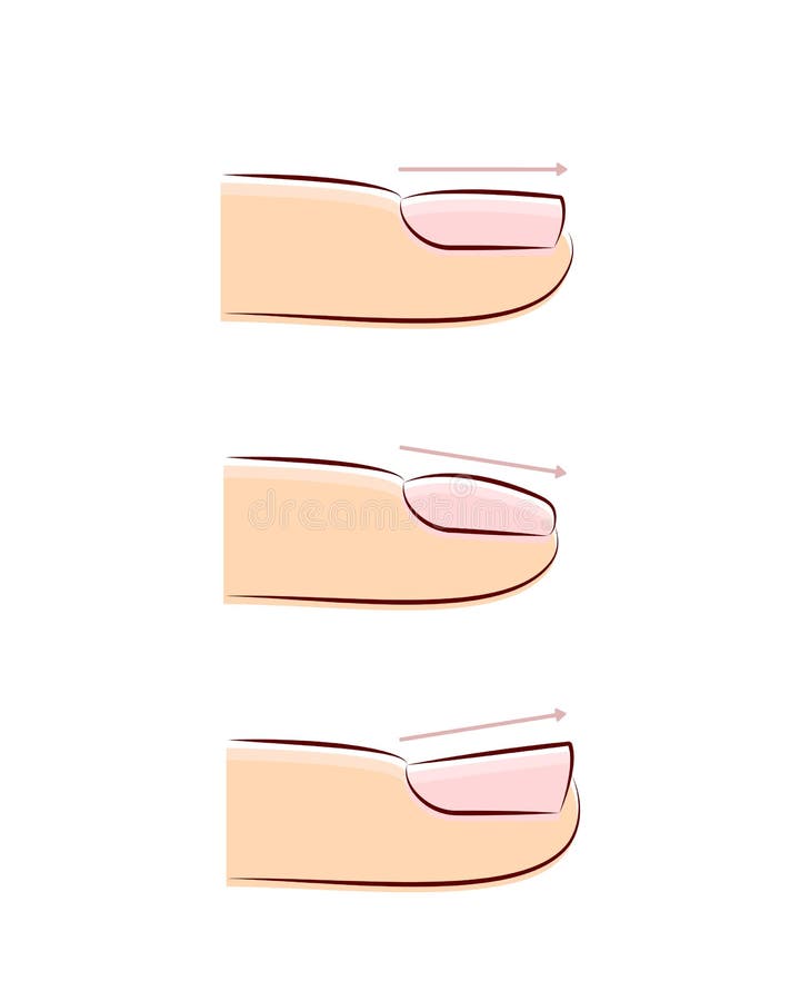 Direction of Nail Growth, Different Types of Fingernail, Flat, Convex and  Concave Nails, Nail Extension Guide, Manicure Stock Vector - Illustration  of nails, school: 248616613