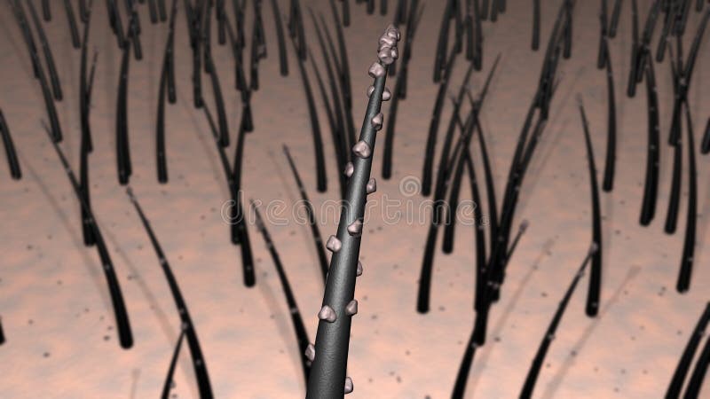 Hair on Skin, Scalp Covered with Dirt Particles, Dandruff, Debris. Close Up  Magnification. View 3. 3d Rendering Illustration Stock Illustration -  Illustration of fibres, bald: 185783798