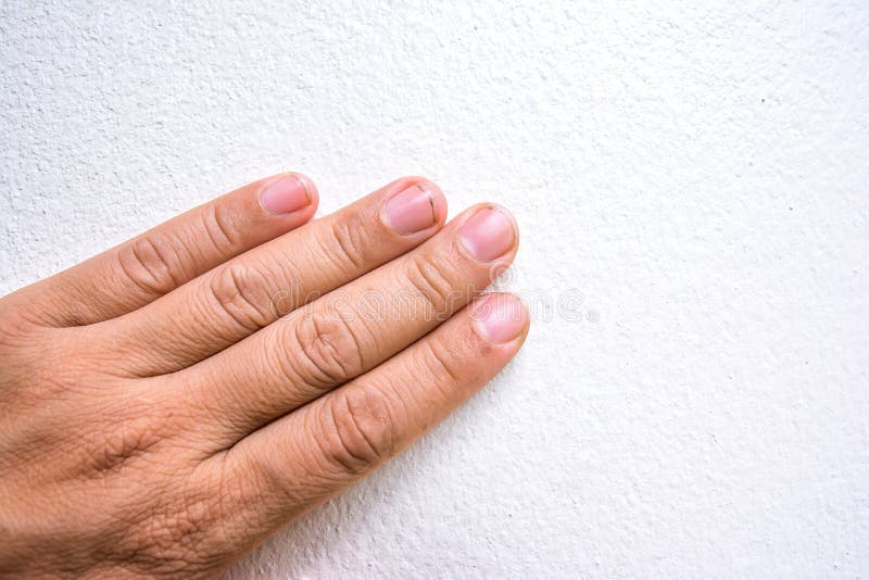 394 Dirty Fingernails Photos Free Royalty Free Stock Photos From Dreamstime