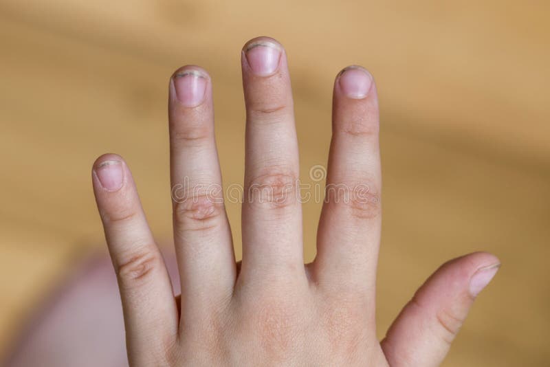 Dirty Long Nails Have Germs Make Sick. Dirt Under the Nails of a Child  Stock Photo - Image of cleanliness, child: 153049404