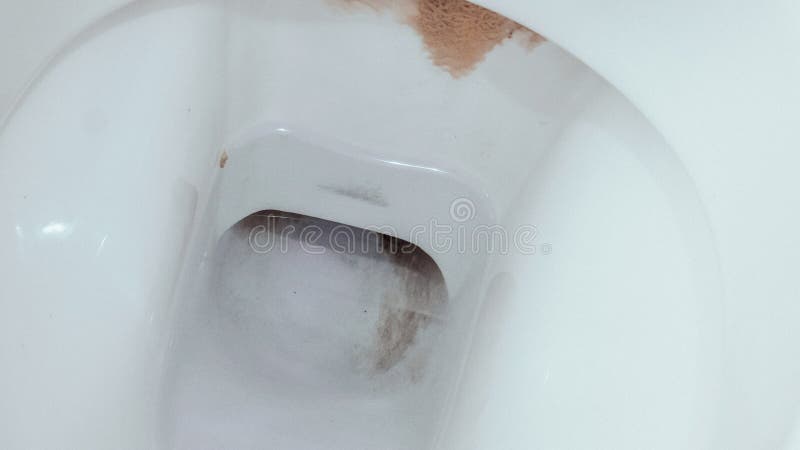 Dirty Unhygienic Seat Of A Toilet Bowl With Limescale Stain At Public