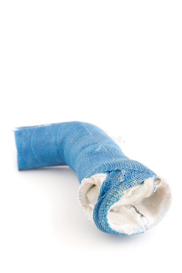 Discarded Blue Fiberglass Arm Cast Stock Photo Image of pain, healing