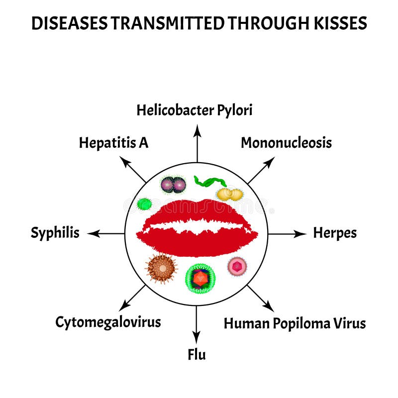 Diseases transmitted through kisses. Syphilis, Herpes, Mononucleosis, Cytomegalovirus, Helicobacter pylori, Human