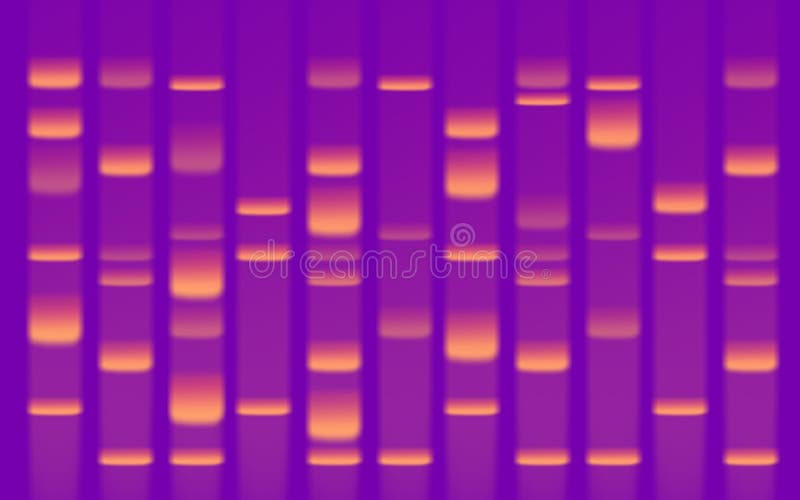 DNA Sequence Gel