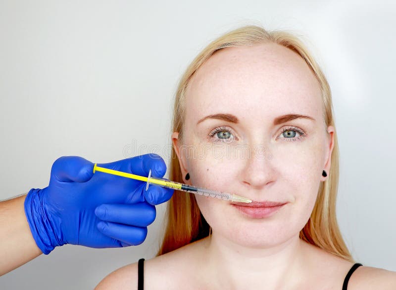 The doctor beautician conducts contour plastic lips: an injection into the lips, lip augmentation. Hyaluronic Acid Injection stock photography The doctor beautician conducts contour plastic lips: an injection into the lips, lip augmentation. Hyaluronic Acid Injection stock photography