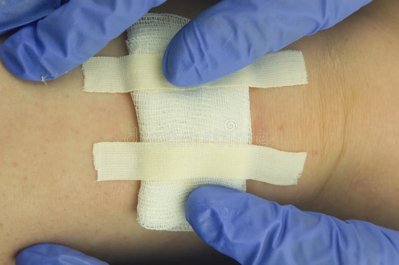 Bandages and Band-AIDS. the Wound is Sealed Stock Image - Image of help ...
