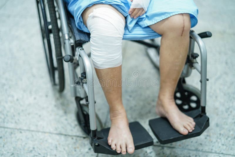 4 416 Knee Bandage Photos Free Royalty Free Stock Photos From Dreamstime