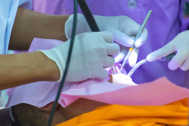 The Doctor Cleaning the Teeth Patient with Ultrasonic Tool Stock Photo