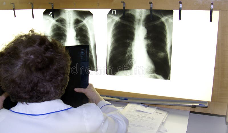 A doctor examines an xray