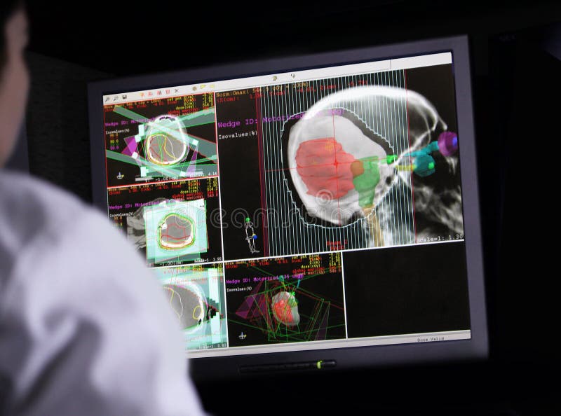 Rear view of a doctor reviewing a digital brain scan on her computer screen looking for cancer tumors and aneurysm. Rear view of a doctor reviewing a digital brain scan on her computer screen looking for cancer tumors and aneurysm.