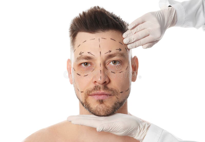Doctor examining man`s face before plastic surgery operation on white stock images Doctor examining man`s face before plastic surgery operation on white stock images