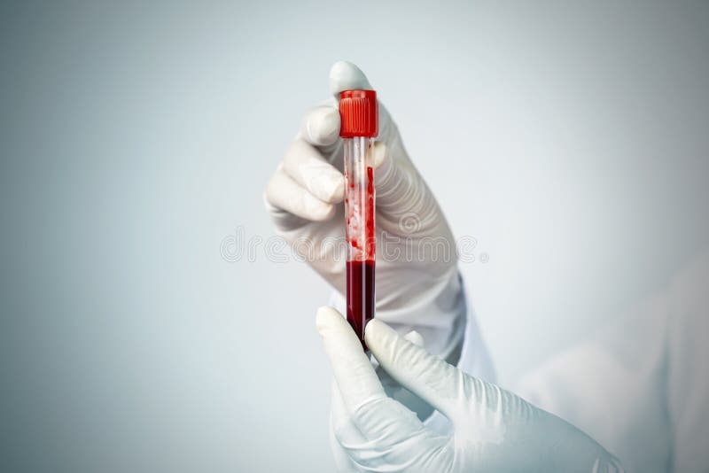 Doctor Hand Holding Blood Collection Tubes in Hematology Laboratory,  Medicine and Science Concept Stock Photo - Image of blood, disease:  152001570