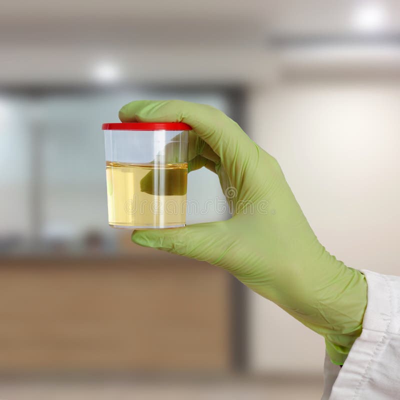 Doctor hold urine sample stock image. Image of laboratory 88516985