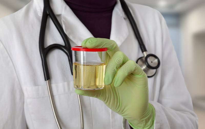 Doctor hold urine sample stock image. Image of laboratory 88516985