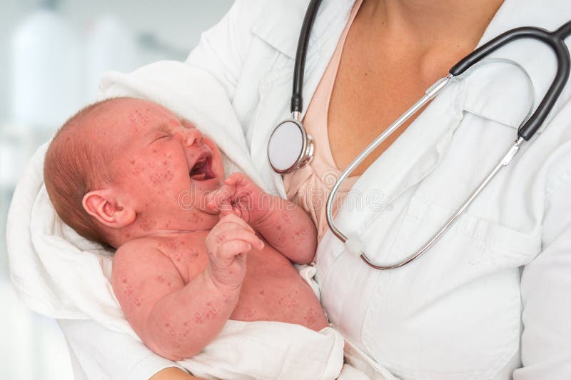 Doctor holding a newborn baby which is sick rubella or measles stock photo Doctor holding a newborn baby which is sick rubella or measles stock photo