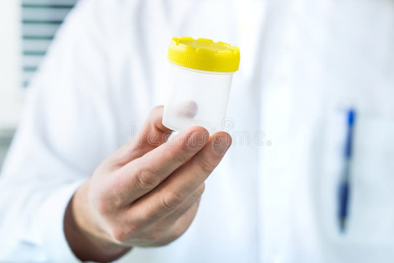 Doctor holding urine sample cup. Medical test in hospital.