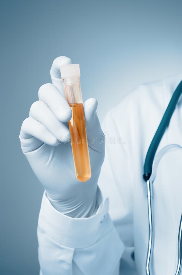 Hand Holding A Urine Sample Stock Image Image of science, holding 38866169