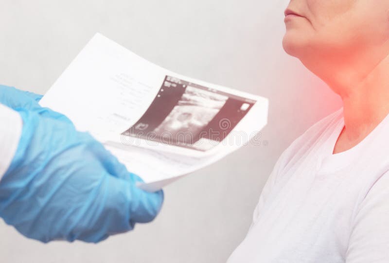 The doctor holds an ultrasound examination of the thyroid gland of an elderly woman whose nodes in the thyroid gland and stock photo The doctor holds an ultrasound examination of the thyroid gland of an elderly woman whose nodes in the thyroid gland and stock photo